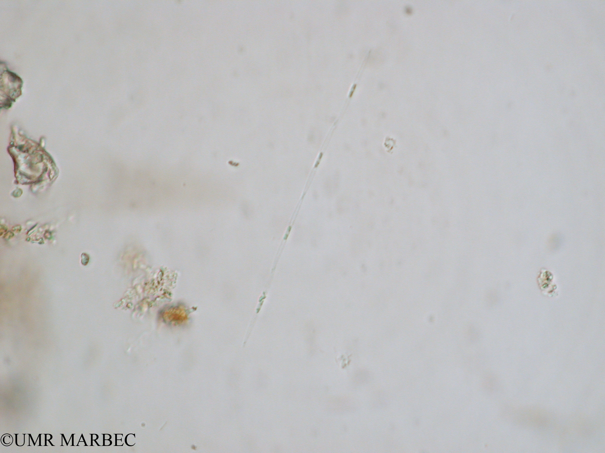 phyto/Tulear Lagoon/all/ICAR2 Avril 2008/Pseudo-nitzschia spp (Pseudonitzschia sp1 x1.5x40 b)(copy).jpg